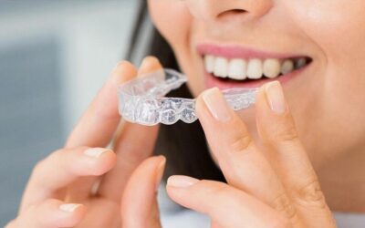 Cost of Invisalign in Ohio