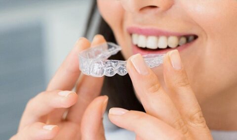 Cost of Invisalign in Ohio | Cleveland Dental Institute | Clear Aligners