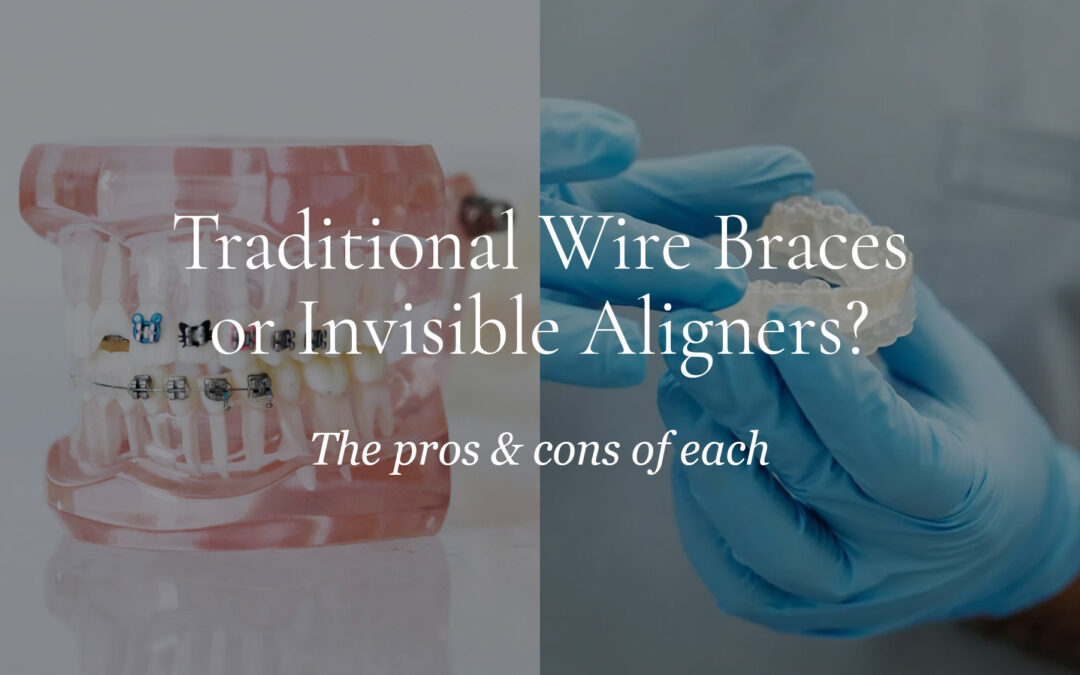 Wire Braces Invisible Aligners | Pros and Cons of Traditional Braces vs. Invisible Aligners | CDI Ohio