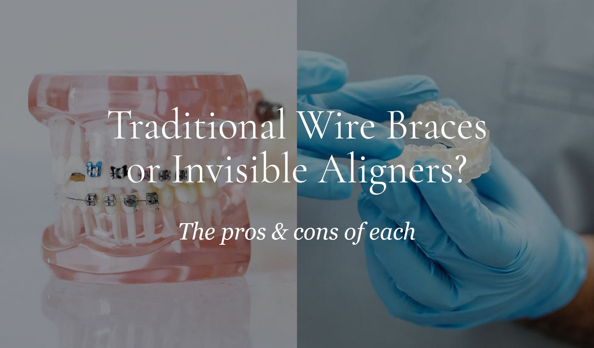 Wire Braces Invisible Aligners | Pros and Cons of Traditional Braces vs. Invisible Aligners | CDI Ohio