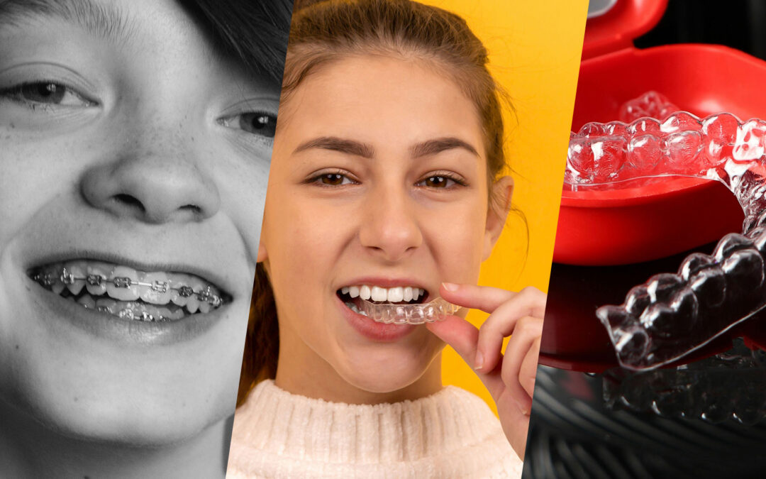 Invisalign vs. ClearCorrect vs. Traditional Braces | Ohio Orthodontists | Clear Aligners | CDI Ohio