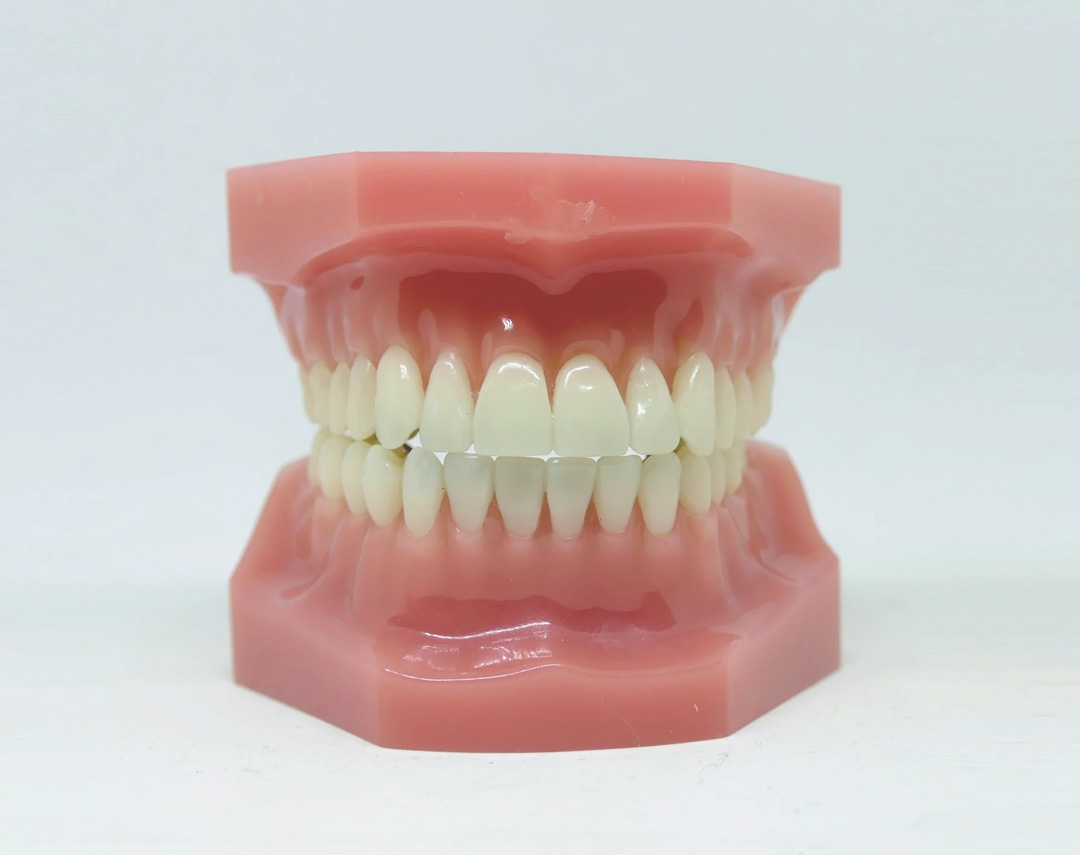 CDI Ohio Dental Office Services | Dentures and Partials