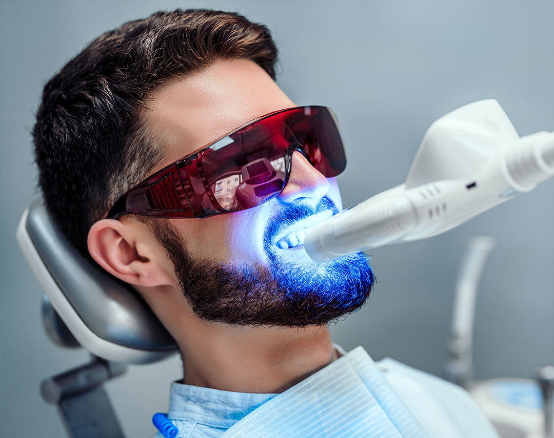 CDI Ohio Dental Office Services | Teeth Whitening | ZOOM Whitening