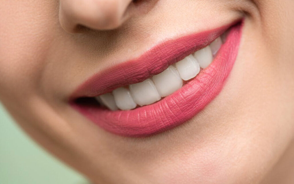 Smile Makeover Options: From Whitening to Veneers | CDI Ohio | Cleveland Dental Institute