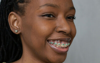 Metal Braces: Everything You Need to Know About Traditional Braces
